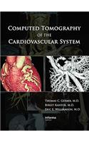 Computed Tomography of the Cardiovascular System