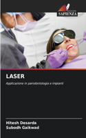 Laser