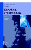 Knochenkrankheiten