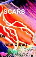 Scars