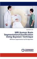 MRI Human Brain Segmentation/Classification Using Bayesian Technique