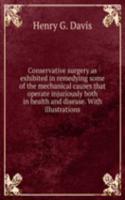CONSERVATIVE SURGERY AS EXHIBITED IN RE
