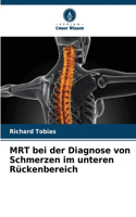 MRT bei der Diagnose von Schmerzen im unteren Rückenbereich