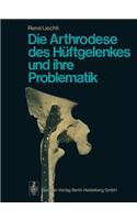 Die Arthrodese Des Hüftgelenkes Und Ihre Problematik