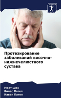 Протезирование заболеваний височно-нижн&