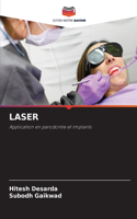 Laser