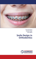 Smile Design in Orthodontics