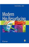 Modern Hip Resurfacing