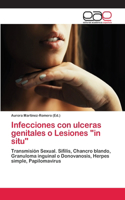 Infecciones con ulceras genitales o Lesiones 