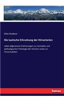 luetische Erkrankung der Hirnarterien