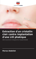 Extraction d'un cristallin clair contre implantation d'une LIO phakique