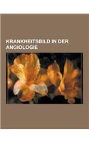 Krankheitsbild in Der Angiologie: Ulcus Cruris, Kawasaki-Syndrom, Arteriosklerose, Periphere Arterielle Verschlusskrankheit, Embolie, Krampfader, Aort(German)