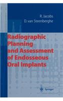 Radiographic Planning and Assessment of Endosseous Oral Implants