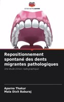 Repositionnement spontané des dents migrantes pathologiques