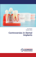 Controversies in Dental Implants