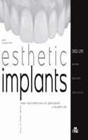 Esthetic Implants -How to think about complex cases in anterior - areas with a global approach to the patient smile (2 books)
