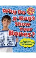 Why Do X-Rays Show Your Bones?: Questions about Bones and the Skeleton(Human Body FAQ)