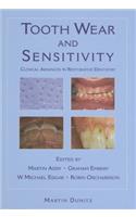 Tooth Wear and Sensitivity