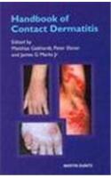 Handbook of Contact Dermatitis