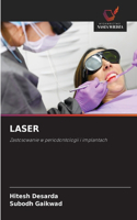 Laser