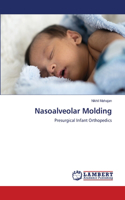 Nasoalveolar Molding