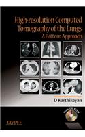 High-Resolution Computed Tomography of the Lungs: A Pattern Approach with CD-ROM
