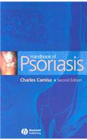 Handbook of Psoriasis