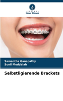 Selbstligierende Brackets