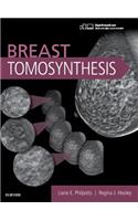 Breast Tomosynthesis