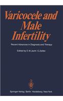 Varicocele and Male Infertility
