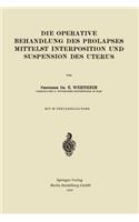 Operative Behandlung Des Prolapses Mittelst Interposition Und Suspension Des Uterus