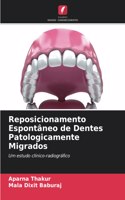 Reposicionamento Espontâneo de Dentes Patologicamente Migrados
