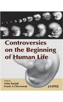 Controversies on the Beginning of Human Life