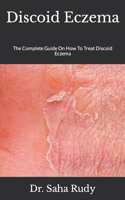 Discoid Eczema