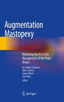 Augmentation Mastopexy