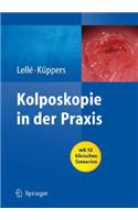 Kolposkopie in Der Praxis