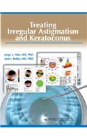 Treating Irregular Astigmatism and Keratoconus