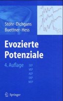 Evozierte Potentiale: Sep-Vep-Aep-Ekp-Mep