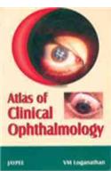 Atlas of Clinical Ophthalmology