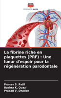 fibrine riche en plaquettes (PRF)