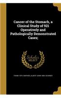 Cancer of the Stomach, a Clinical Study of 921 Operatively and Pathologically Demonstrated Cases;
