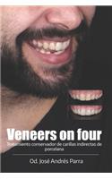 Veneers on four
