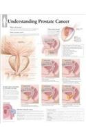 Understanding Prostate Cancer Paper Poster