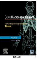 Src: 100 Diagnosticos Principales En Torax