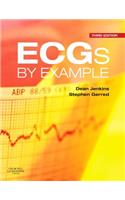 Ecgs by Example