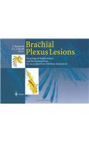 Brachial Plexus Lesions