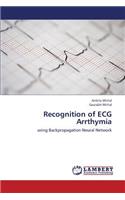 Recognition of ECG Arrthymia