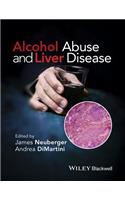 Alcohol Abuse and Liver Disease