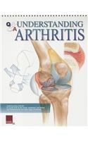 Understanding Arthritis Flip Chart