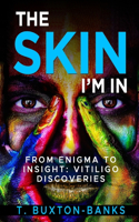 Skin I'm In: From Enigma to Insight: Vitiligo Discoveries